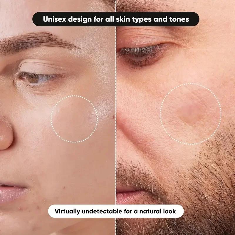 360 stuks/doos acnepleisters - - Face Oil recensie en prijs