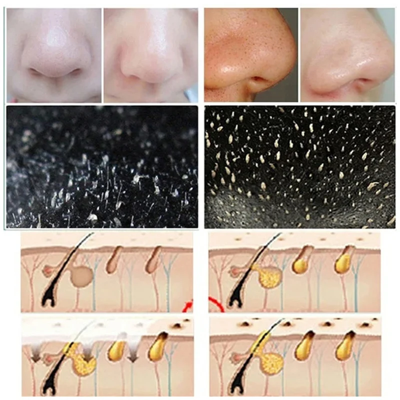 10 Stuks Mee-eter Neus Strips  - Cleanser Face recensie en prijs