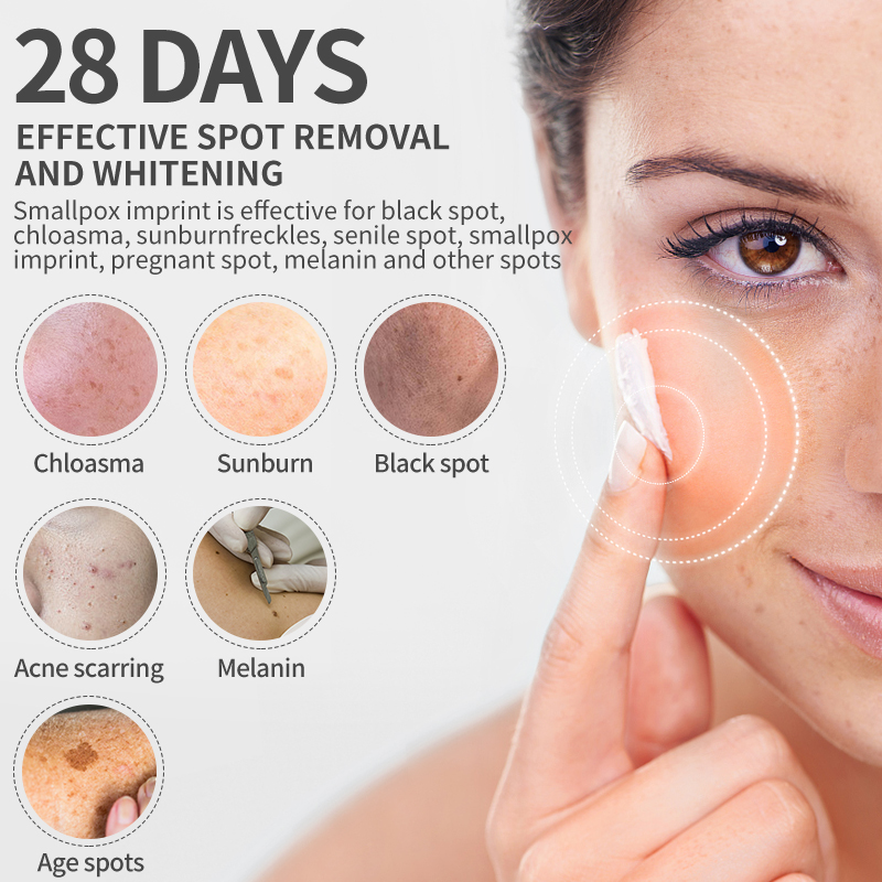 Dimollaure Whitening Sproet Cr - Retinol Cream recensie en prijs