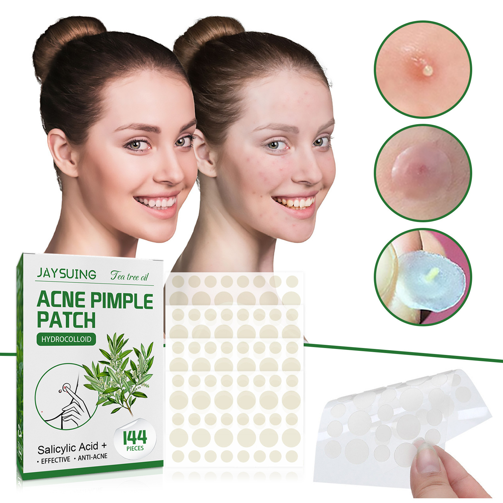 Hydrocolloïde acnepleisters -  - Face Oil recensie en prijs