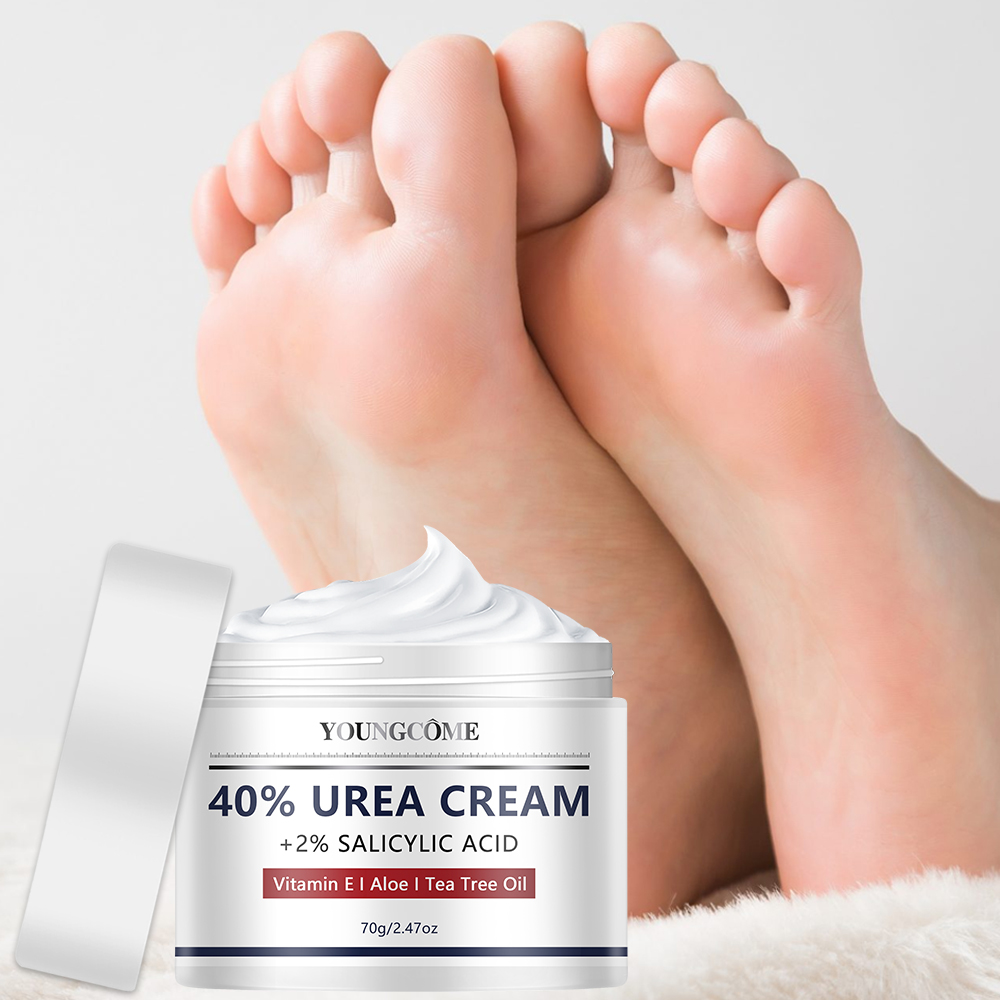 Ureecrème voor voet- en handve - Urea Foot Cream recensie en prijs